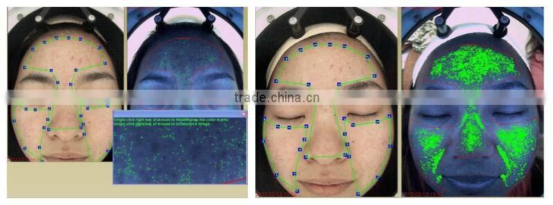 Multi-language magic mirror skin analyzer with CE certificate