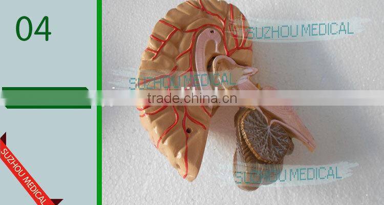 Distribution of brain and cerebral arteries