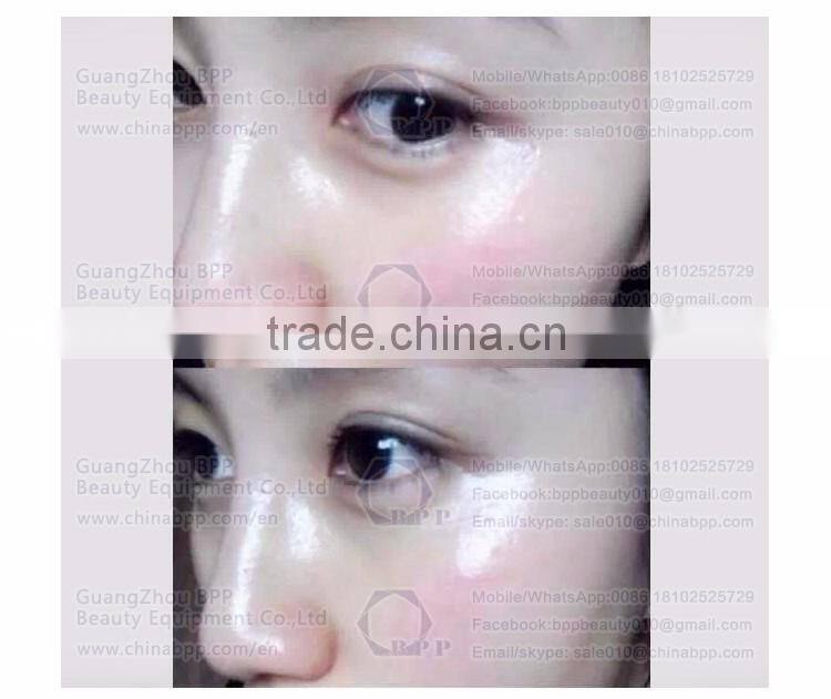 Korea origianal vacuum mesogun whitening injection super penetration removing facial wrinkles skin needling equipment