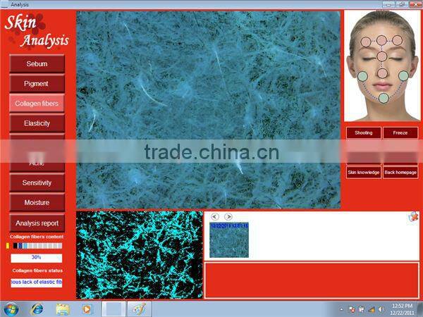 New Product Portable Facial Skin Analyzer Beauty Equipment