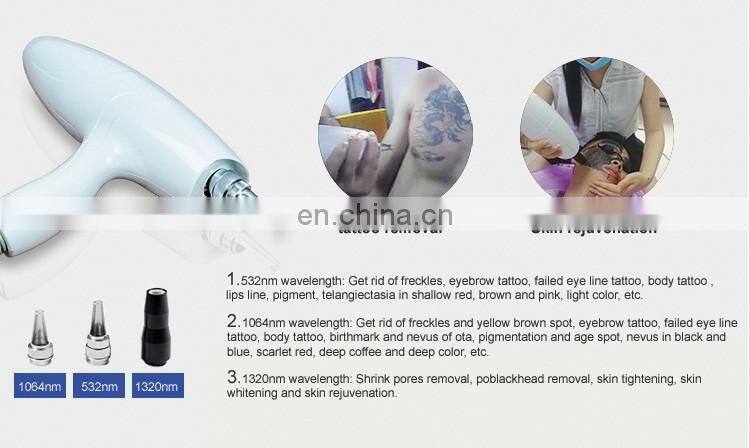Our company want distributor! Factory direct sale nd yag laser q switch tattoo removal laser