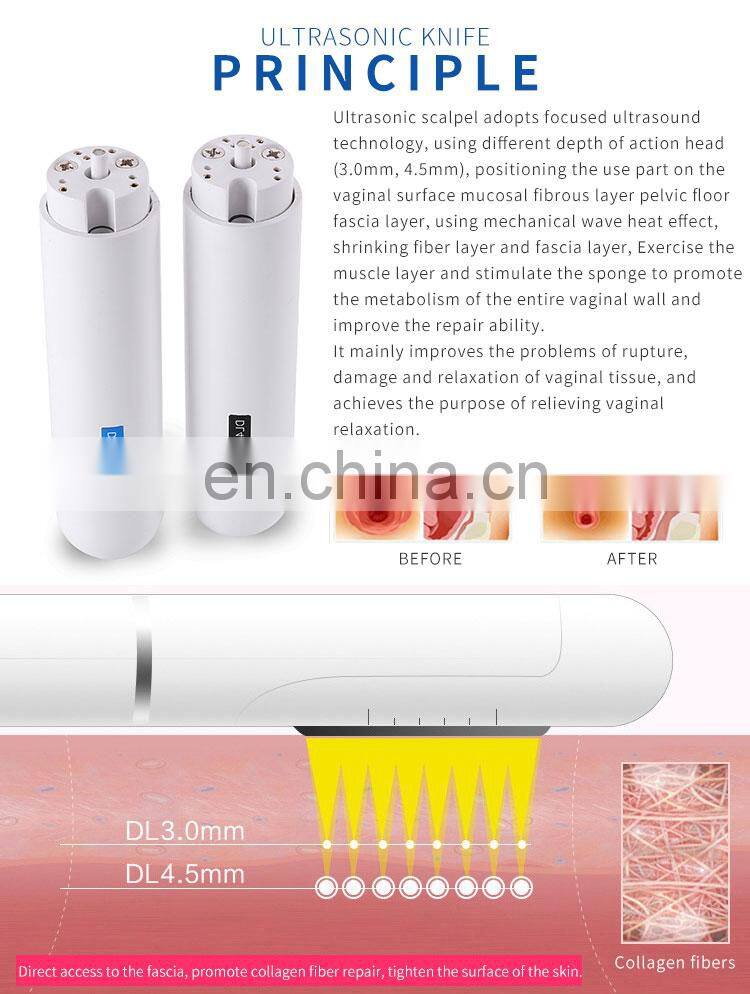 High Effective Hifu Vaginal Tightening Treatment Beauty Machine For Easy Use