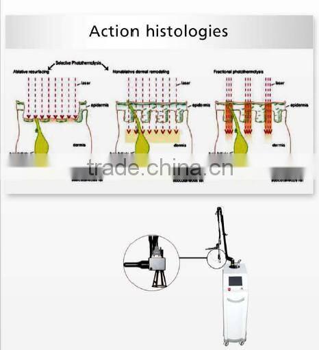 CO2 Fractional laser laser resurfacing machine