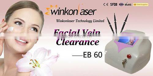 Super star products! the latest spider vein removal machine/ spider vein removal/laser spider vein removal