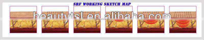 Lingmei professional Fractional RF Superficial Fractional RF SFR Machine