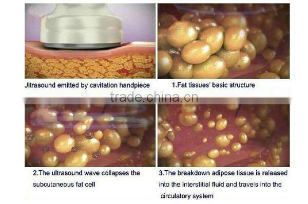 Factory price ultrasound cavitation and rf beauty machine