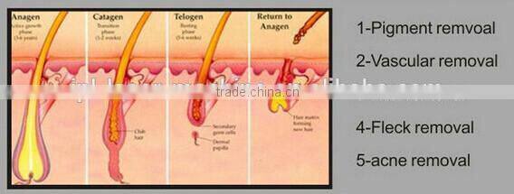 2016 most hot sale super hair removal ipl shr / shr ipl depilation / shr hair removal machine for sale