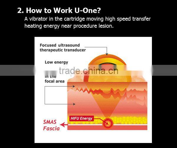 SMAS High Intensity Focus Ultrasound System clinic Skin rejunveation beauty Machine