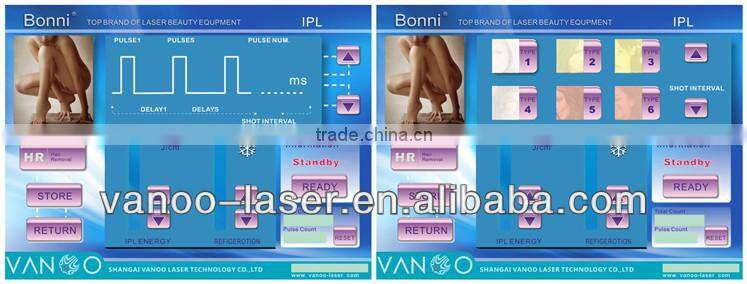 Everlasting hair removal medical machine for supply