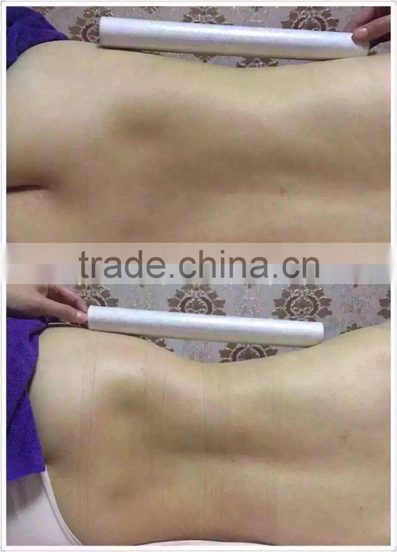 2016 high quality best selling fat reduction body shaping weight loss instrument