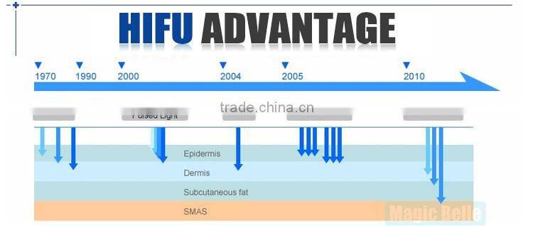 Potable HIFU machine hifu skin tightening machine hifu beauty machine in alibaba