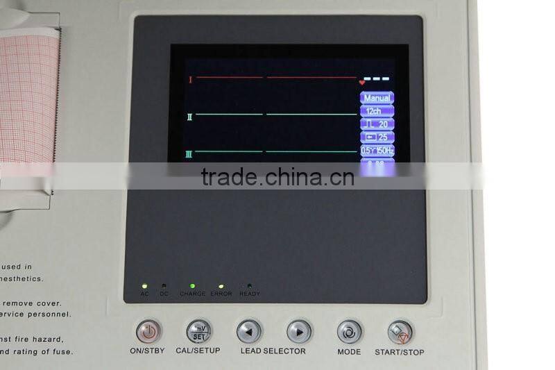 EKG-903A2 China factory sale 3 Channel portable ecg machine