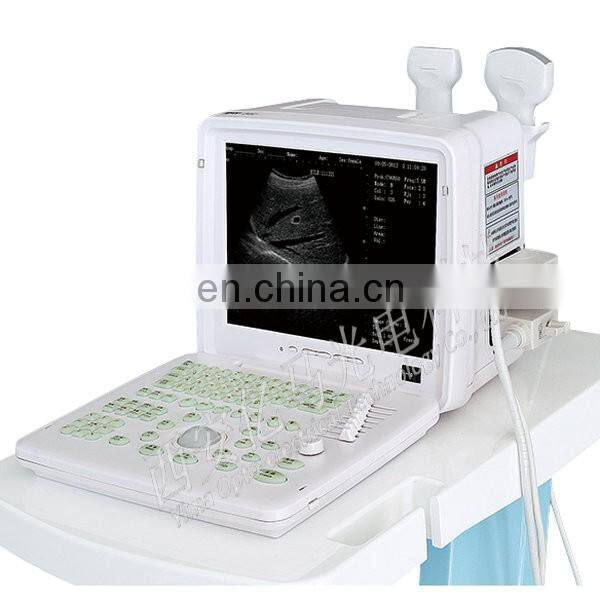 DW360 Portable Full -Digital Ultrasound Scanner