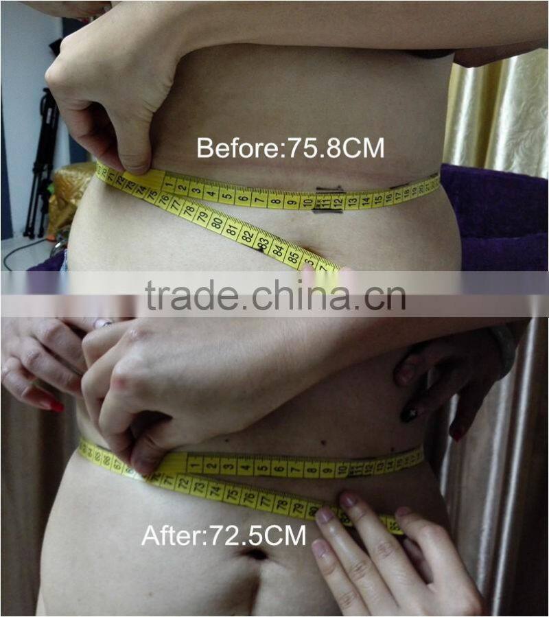 8MM and 13MM Portable Lipo HIFU System/ 1 session 1 smaller dress size
