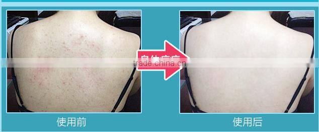 Nature extract jasmine/starwberry/lemon/blueberry/rose /pinch/aloe /vanilla Skin Whitening Shower Gel