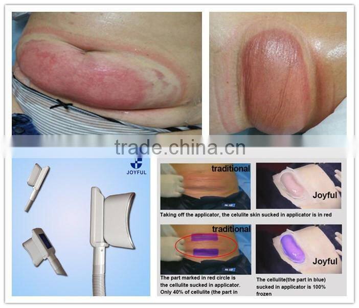 Multi-Function Beauty Equipment reduce belly fat naturally
