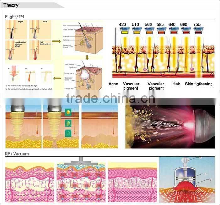 Hot selling CE TUV imported lamp portable 6 handles elight ipl home light depilator