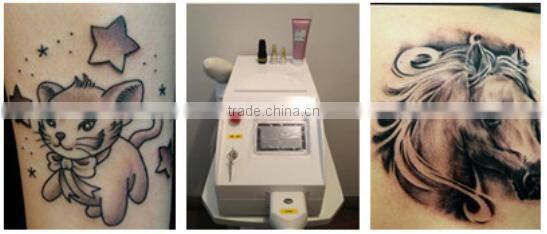 Portable Mini laser Q Switched ND:YAG best tattoo removal machine