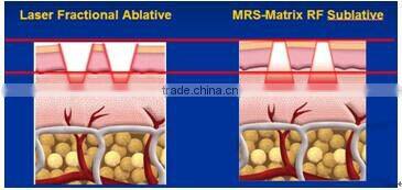 Fractional RF Professional Fractional RF Microneedle Machine Wholesale RF Fractional Micro Needle