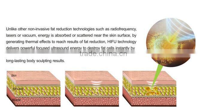 LS08-laura HOT sale Ultrashape / Liposonix / HIFU Slimming Machine