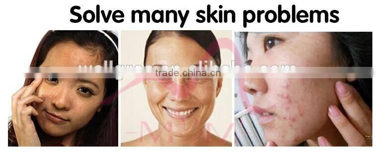 Hot Salling Electroporation & EMS LED Whitening beauty device for face care with CE Approval