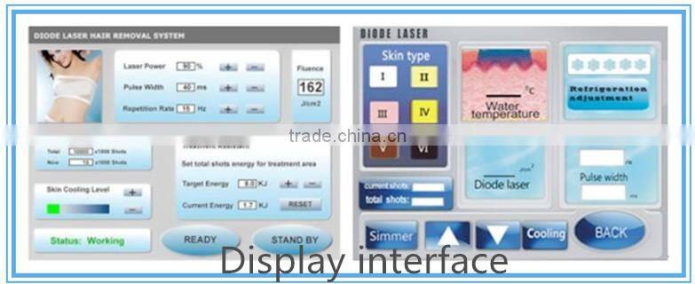 Alibaba express diode laser hair removal germany