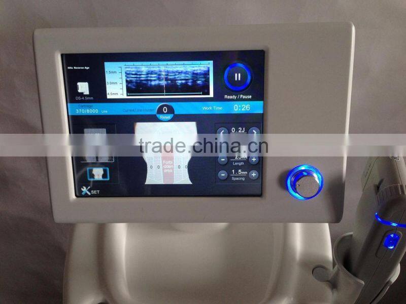 Hifu/hifu machine/High Intensity Focused Ultrasound Hifu