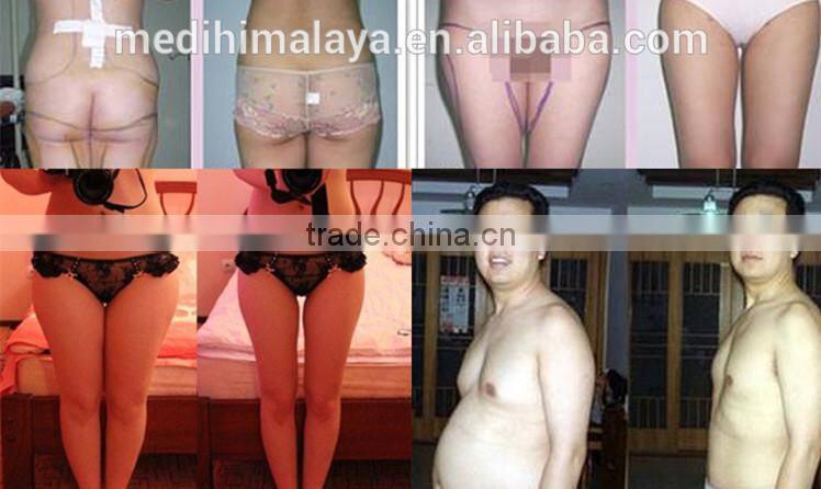 cold sculpting machine vertical convenient to carry