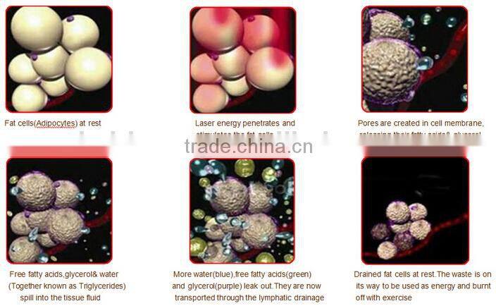 Antifreeze membranes multifunctional criolipolisis / cryolipolysis antifreeze membrane for freeze fat machine