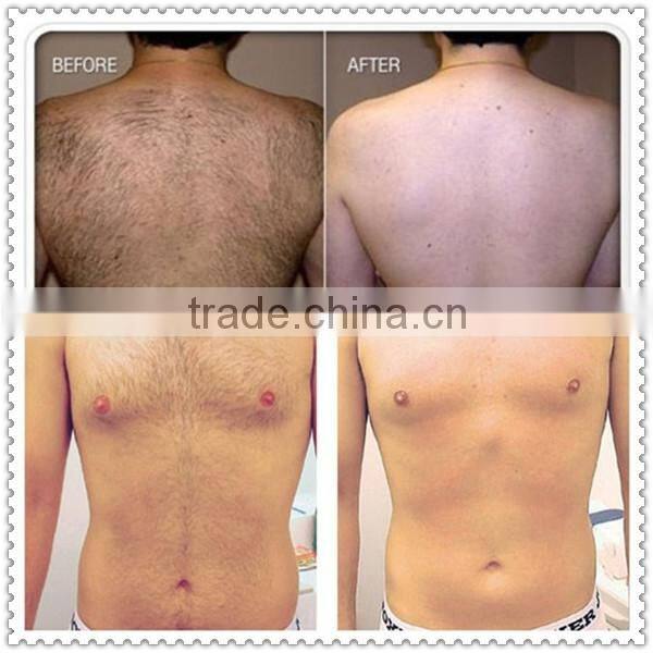 Very popular face hair removal machine