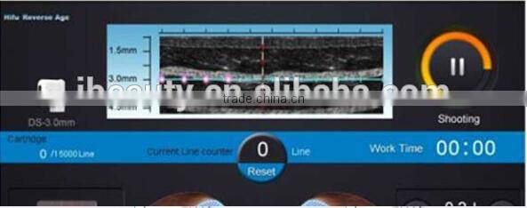 2015 Most Popular Lift Eyes&Brows Remove Crows Feet & Pouches High Intensity Focused Ultrasound Hifu