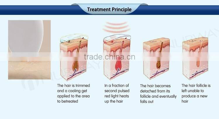 12*20 big spot size 10 layer laser bars permanent alexandrite 808nm diode laser hair removal machine price