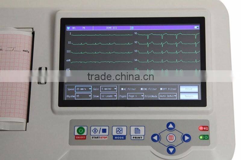 China Cheap Price Portable Six-channel Software Electrocardiograph Color Touch Screen 6 channel portable ecg machine