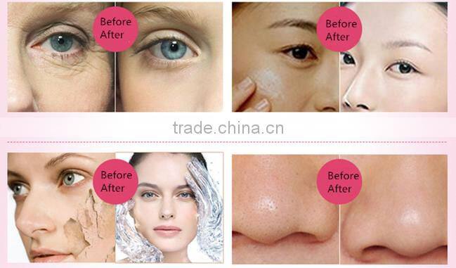 Competitive Electric Ionic Portable Mini Facial Steamer