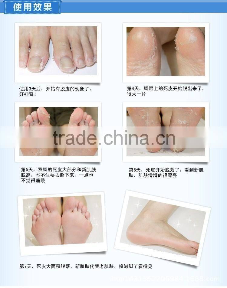 1pair per bag AFY 60mins effective beauty socks exfoliating foot peeling mask