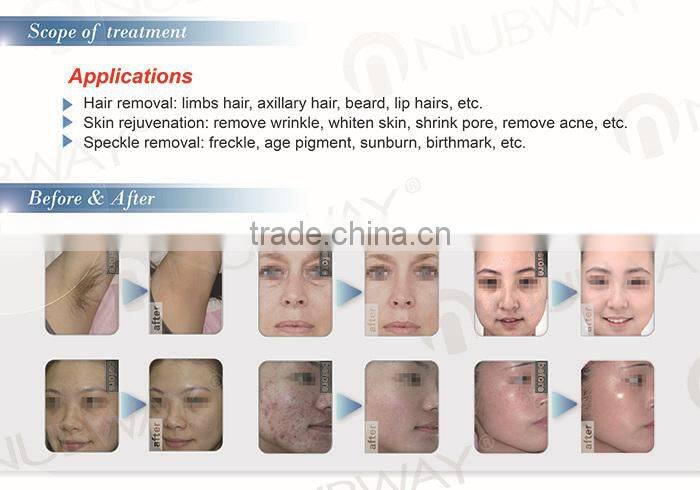 E-light SHR Hair Removal Beauty Device No No Hair Skin Care Product Supply