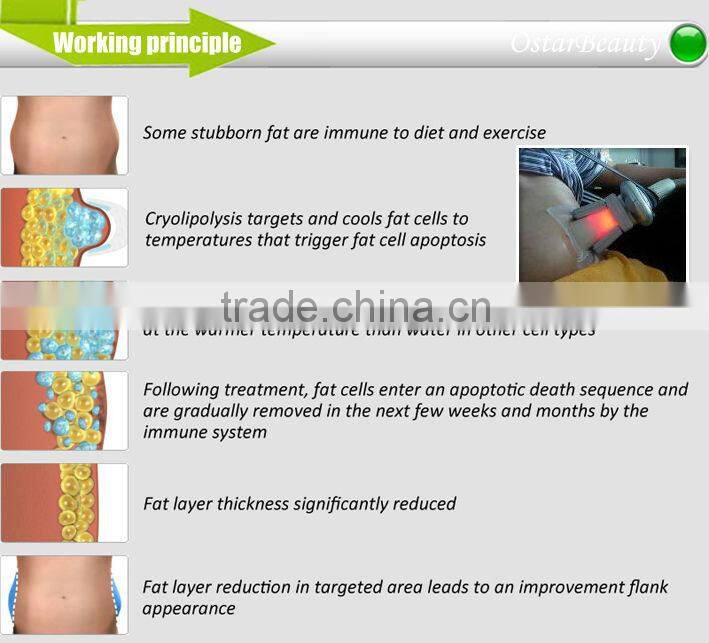 (4 CRYO handle) fat freeze liposuction cryolipolysis body slimming machine