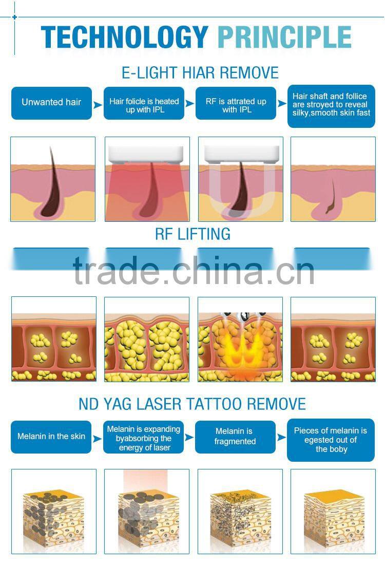 Lingmei Depilacion Laser Vertical Long Pulse Nd Yag Laser With Big Spot Size