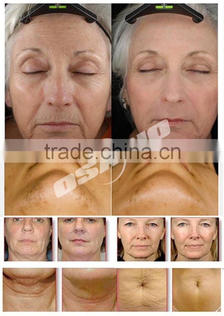 Ultrasonic Body Slimming Beauty Instrument Liposuction Cavitacion Multipolar RF Machine