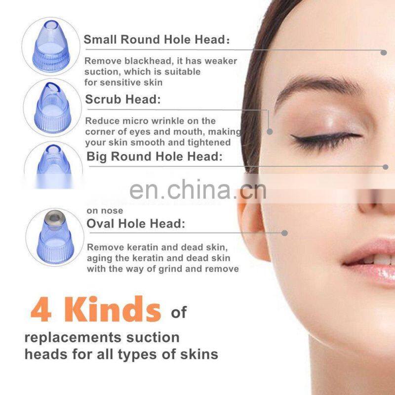 2018 China supplier vacuum pore nose blackhead sucker
