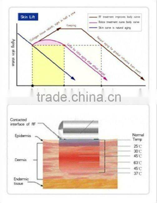 VY-M2 Hot sale ultrasonic body beauty slim massager machine