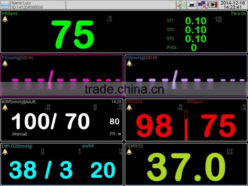 Cheap Patient Monitor with Pulse oximeter Monitor for Doctor Diagnose f15