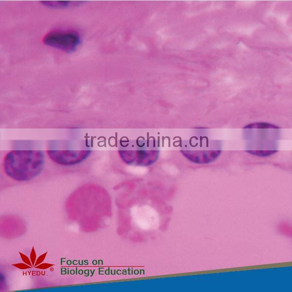 Fixed set 100 pieces for higher medical educational histopathology slides