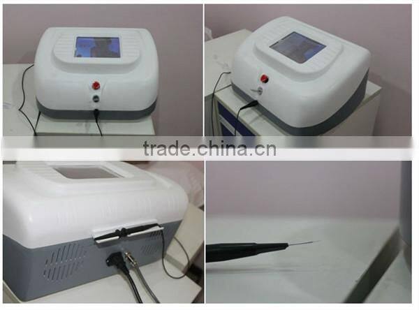 Professional painless spider vein removal for removal soften blood vessels