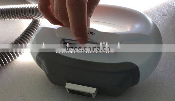 SHR IPL OPT hair removal & skin rejuvenation