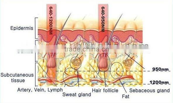 2015 Latest SHR Hair Removal Laser SHR Machine Best Selling Hot Chinese ProductsCE/ISO