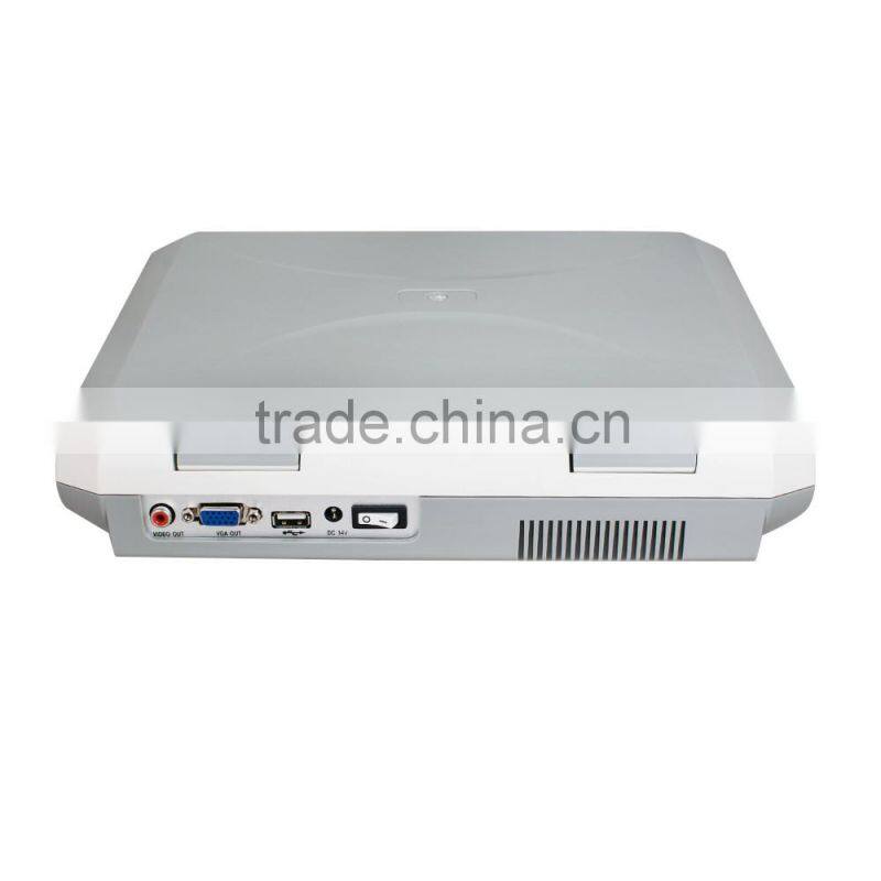 Carejoy laptop Ultrasound Machine Ultrasound Scanner with convex probe RUS-9000F2 by CE ISO approved