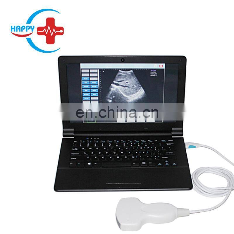 HC-A008 Hot Sale USB ultrasound probe price for pc laptop