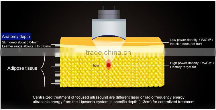 Safety ultrasound slimming weight loss fat reduction liposunic machine price