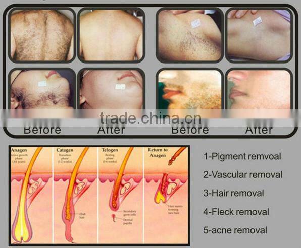 High technology 2 handles multifunctional salon use shr ipl hair removal machine